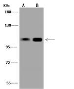 USP28 Antibody in Western Blot (WB)