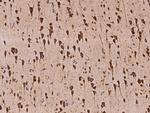 VARS Antibody in Immunohistochemistry (Paraffin) (IHC (P))