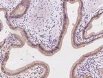 VAV2 Antibody in Immunohistochemistry (Paraffin) (IHC (P))