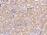 VPS25 Antibody in Immunohistochemistry (Paraffin) (IHC (P))