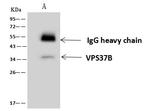 VPS37B Antibody in Immunoprecipitation (IP)