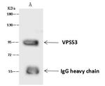 VPS53 Antibody in Immunoprecipitation (IP)