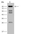 VPS53 Antibody in Western Blot (WB)