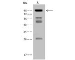 VPS53 Antibody in Western Blot (WB)