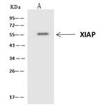 XIAP Antibody in Immunoprecipitation (IP)