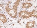 ZMAT1 Antibody in Immunohistochemistry (Paraffin) (IHC (P))