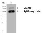 ZMAT1 Antibody in Immunoprecipitation (IP)