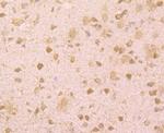 BMAL1 Antibody in Immunohistochemistry (Paraffin) (IHC (P))