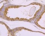 BMAL1 Antibody in Immunohistochemistry (Paraffin) (IHC (P))