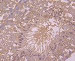 ASK1 Antibody in Immunohistochemistry (Paraffin) (IHC (P))