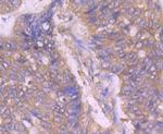 ASK1 Antibody in Immunohistochemistry (Paraffin) (IHC (P))