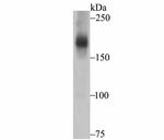 ASK1 Antibody in Western Blot (WB)