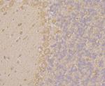 KCNK1 Antibody in Immunohistochemistry (Paraffin) (IHC (P))