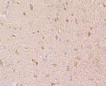 KCNK1 Antibody in Immunohistochemistry (Paraffin) (IHC (P))