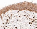 FOXP1 Antibody in Immunohistochemistry (Paraffin) (IHC (P))