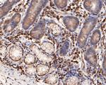 FOXP1 Antibody in Immunohistochemistry (Paraffin) (IHC (P))