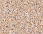 CPEB1 Antibody in Immunohistochemistry (Paraffin) (IHC (P))