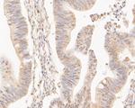 CPEB1 Antibody in Immunohistochemistry (Paraffin) (IHC (P))