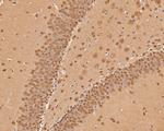 CPEB1 Antibody in Immunohistochemistry (Paraffin) (IHC (P))