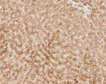 DNA2 Antibody in Immunohistochemistry (Paraffin) (IHC (P))