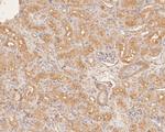 DNA2 Antibody in Immunohistochemistry (Paraffin) (IHC (P))