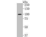 DNA2 Antibody in Western Blot (WB)