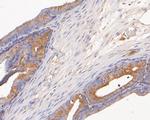 AKR1B1 Antibody in Immunohistochemistry (Paraffin) (IHC (P))