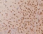 COPS8 Antibody in Immunohistochemistry (Paraffin) (IHC (P))