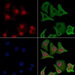 Phospho-RARA (Ser77) Antibody in Immunocytochemistry (ICC/IF)