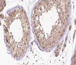 Phospho-RARA (Ser77) Antibody in Immunohistochemistry (Paraffin) (IHC (P))