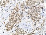 Phospho-RARA (Ser77) Antibody in Immunohistochemistry (Paraffin) (IHC (P))