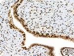 Phospho-RARA (Ser77) Antibody in Immunohistochemistry (Paraffin) (IHC (P))