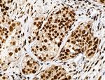 Phospho-RARA (Ser77) Antibody in Immunohistochemistry (Paraffin) (IHC (P))