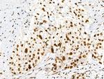 Phospho-RARA (Ser77) Antibody in Immunohistochemistry (Paraffin) (IHC (P))