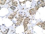 Phospho-RARA (Ser77) Antibody in Immunohistochemistry (Paraffin) (IHC (P))