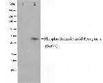 Phospho-RARA (Ser77) Antibody in Western Blot (WB)