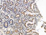 ITGB5 Antibody in Immunohistochemistry (Paraffin) (IHC (P))