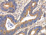 ITGB5 Antibody in Immunohistochemistry (Paraffin) (IHC (P))