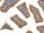 ITGB5 Antibody in Immunohistochemistry (Paraffin) (IHC (P))