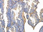 ITGB5 Antibody in Immunohistochemistry (Paraffin) (IHC (P))