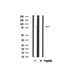 ITGB5 Antibody in Western Blot (WB)