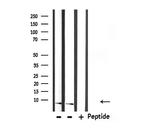 UBA52 Antibody in Western Blot (WB)