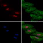 DKC1 Antibody in Immunocytochemistry (ICC/IF)