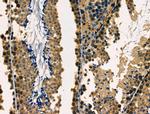 DKC1 Antibody in Immunohistochemistry (Paraffin) (IHC (P))