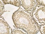 DKC1 Antibody in Immunohistochemistry (Paraffin) (IHC (P))