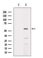 DKC1 Antibody in Western Blot (WB)