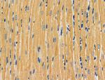 NAA15 Antibody in Immunohistochemistry (Paraffin) (IHC (P))