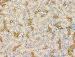 NAA15 Antibody in Immunohistochemistry (Paraffin) (IHC (P))