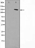 DGKD Antibody in Western Blot (WB)