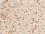 Phospho-FOXO3A (Ser253) Antibody in Immunohistochemistry (Paraffin) (IHC (P))